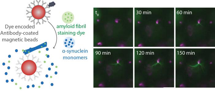 Image: A novel test holds promise for detecting Parkinson’s disease early (Photo courtesy of Wyss Institute)